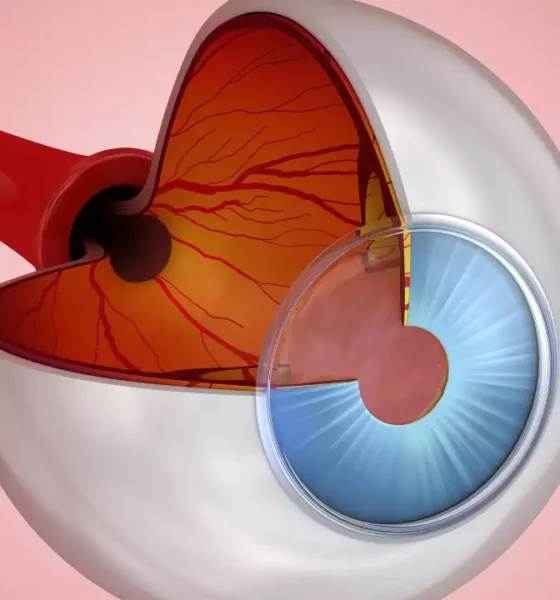 Seeing Clearly: Exploring the Factors Contributing to Glaucoma