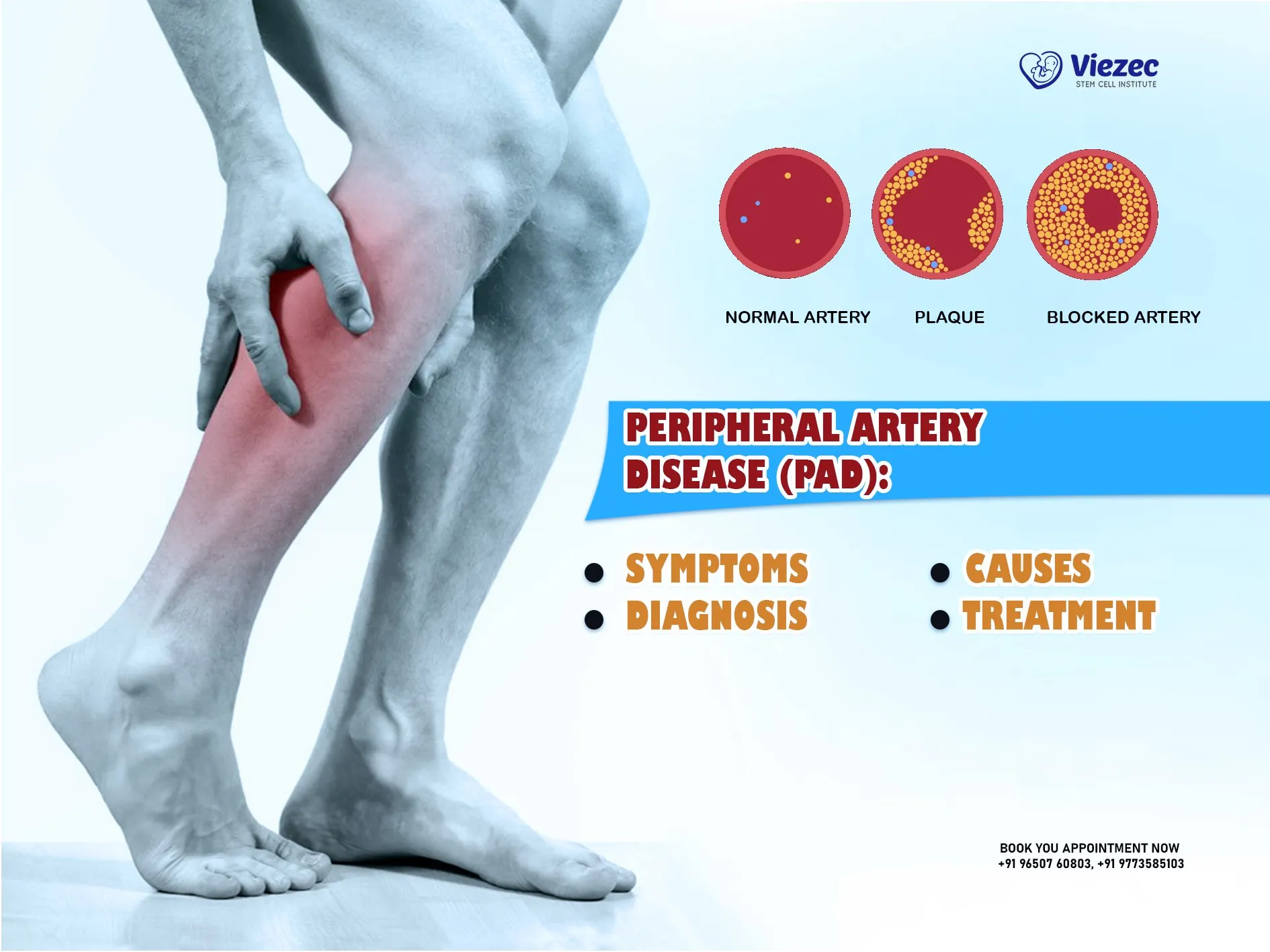 Know the Warning Signs: Peripheral Artery Disease